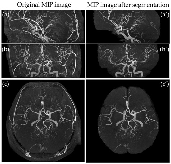 Neurovascular Segmentation